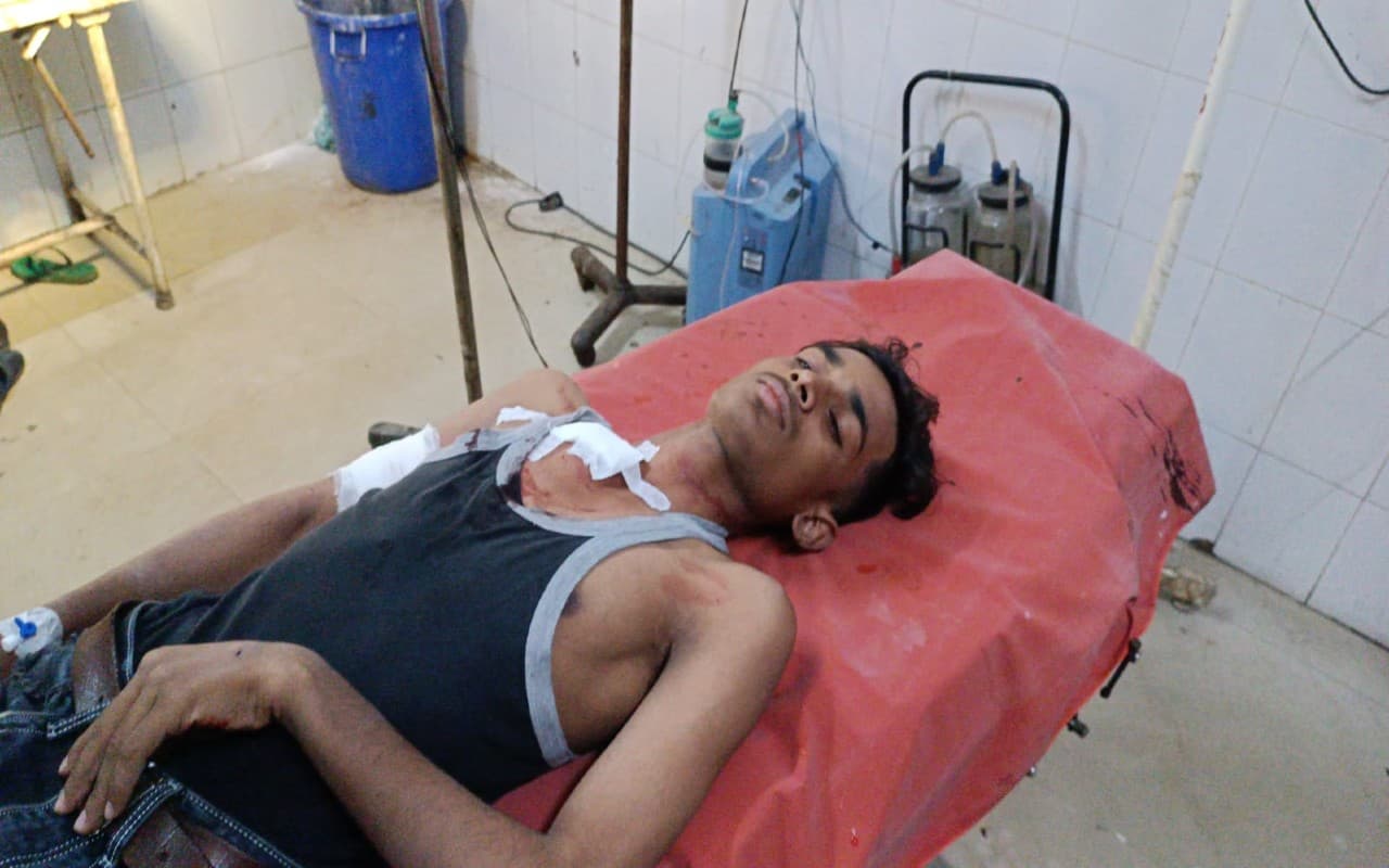 धनबाद में मेला देखने गए गढ़वा के युवक को गोलीमार किया घायल, आरोपी धराया