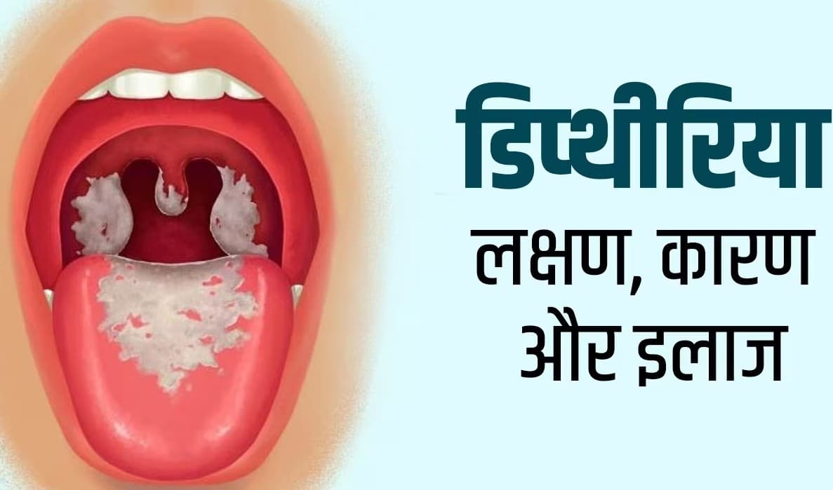 Exclusive: यूपी में गला घोंटू बीमारी से 102 मौतें, अब 1 से 10 नवंबर तक स्कूलों में चलेगा विशेष टीकाकरण अभियान