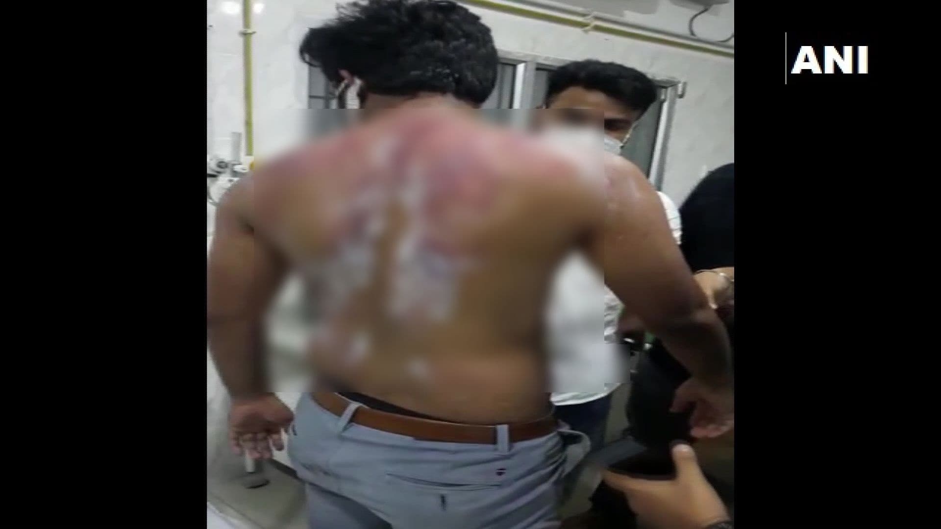 ASSAM: मरीज की मौत पर परिजनों ने डॉक्टर को बुरी तरह पीटा, वीडियो वायरल होने के बाद CM ने दिये जांच के आदेश