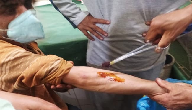 पुलवामा में CRPF के वाहन पर आतंकियों ने फेंका ग्रेनेड, हवा में फटने से सात नागरिक घायल