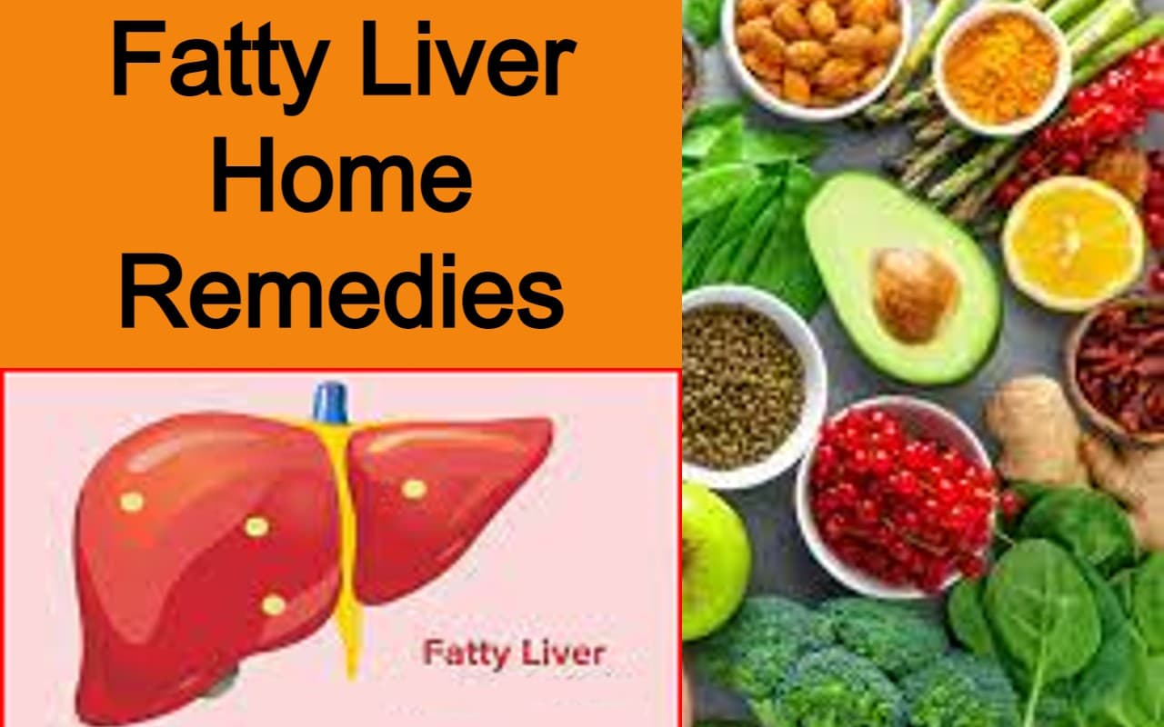 फैटी लीवर की परेशानी हो जाएगी दूर आजमाएं ये आसान घरेलू उपाय, जानें उपचार