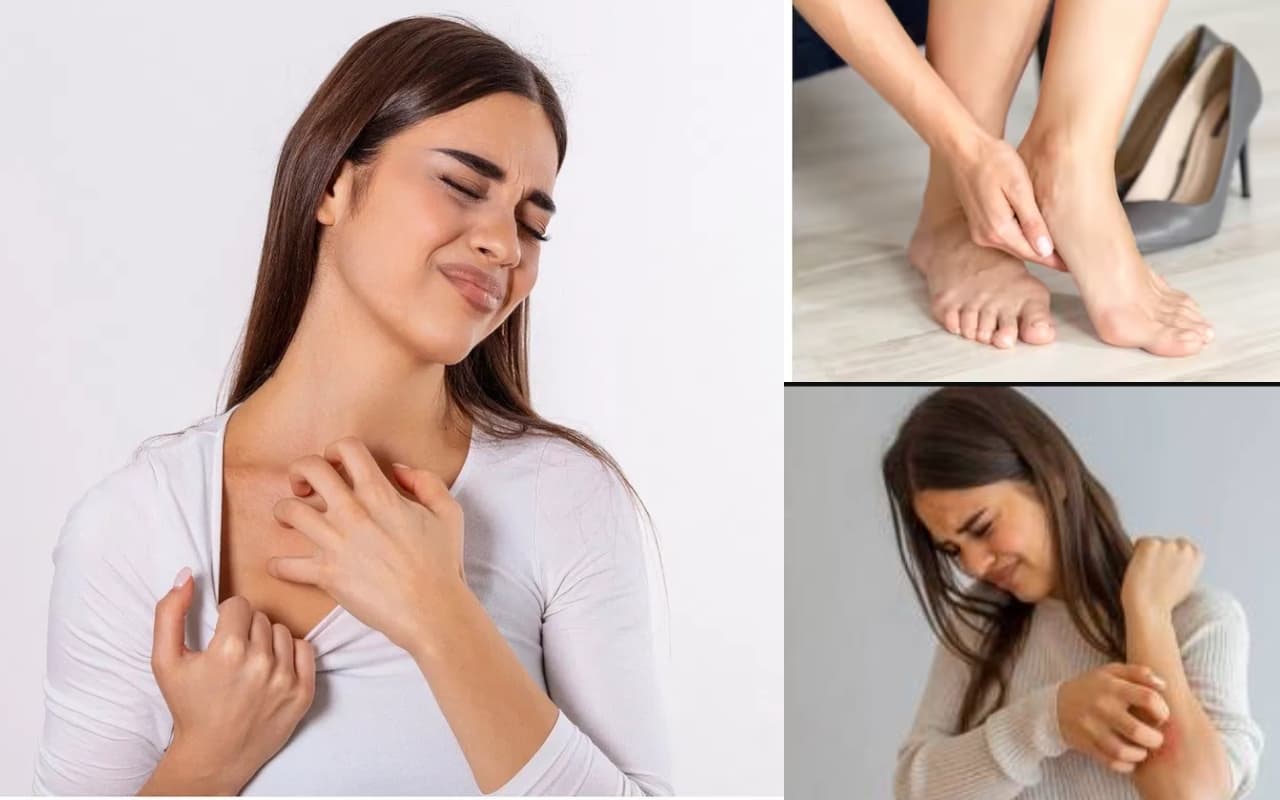 मानसून के दौरान फंगल इंफेक्शन से कैसे बचें, जानें एक्सपर्ट की राय