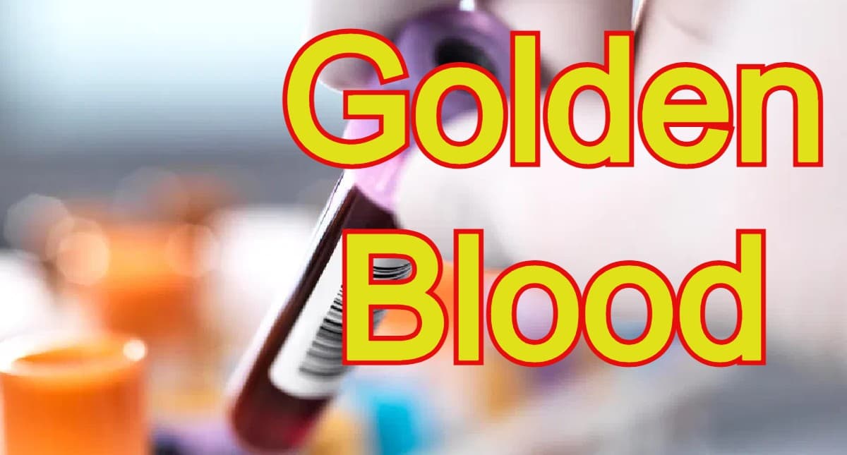 Golden Blood एक ऐसा ब्लड ग्रुप, जो अबतक दुनिया भर में केवल 45 लोगों में मिला, जानें पूरी डिटेल