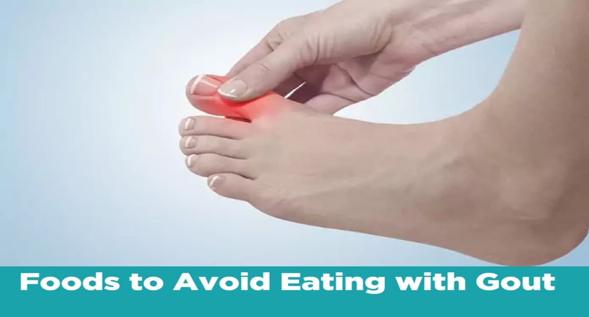 Home Remedies for Uric Acid: सर्दियों में बढ़ जाती हैं यूरिक एसिड की समस्या, इन तरीकों से करें कंट्रोल