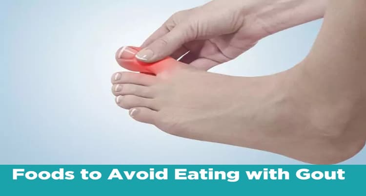 Home Remedies for Uric Acid: सर्दियों में बढ़ जाती हैं यूरिक एसिड की समस्या, इन तरीकों से करें कंट्रोल