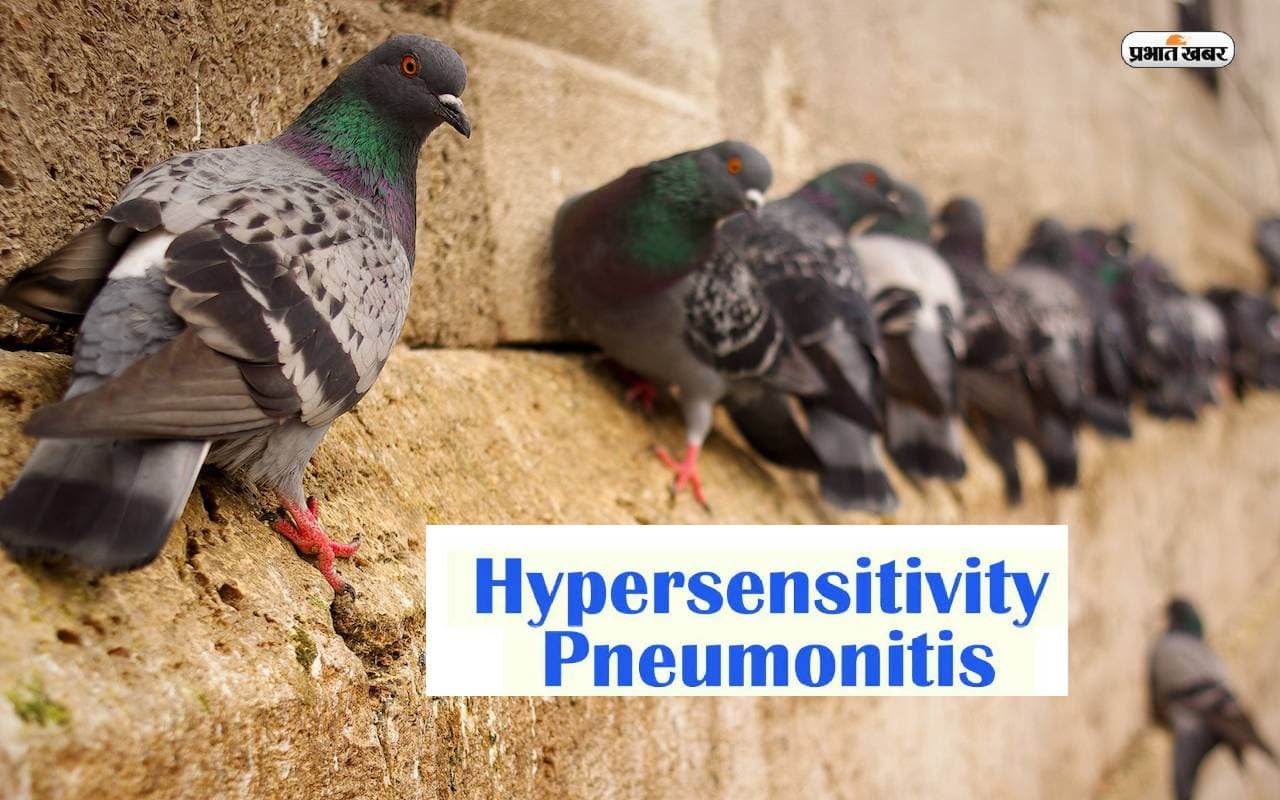 Hypersensitive Pneumonia: कबूतर पालने के हैं शौकीन तो हो जाएं सावधान, हो सकती है ये गंभीर बीमारी