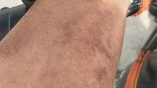 Agra News: आगरा पुलिस का अमानवीय चेहरा आया सामने, एसआई ने युवक को दी थर्ड डिग्री, बहन से की अभद्रता