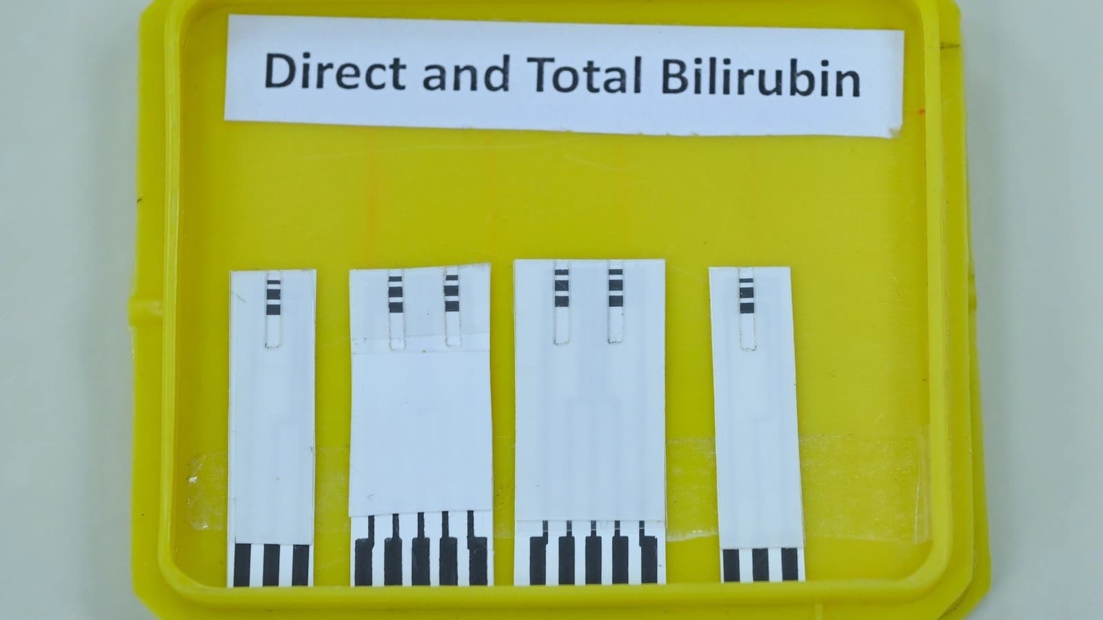 Explainer: क्या है IIT कानपुर की नॉन-एंजाइमी इलेक्ट्रोकेमिकल सेंसिंग स्ट्रिप, सिर्फ एक बूंद खून में करेगी जांच