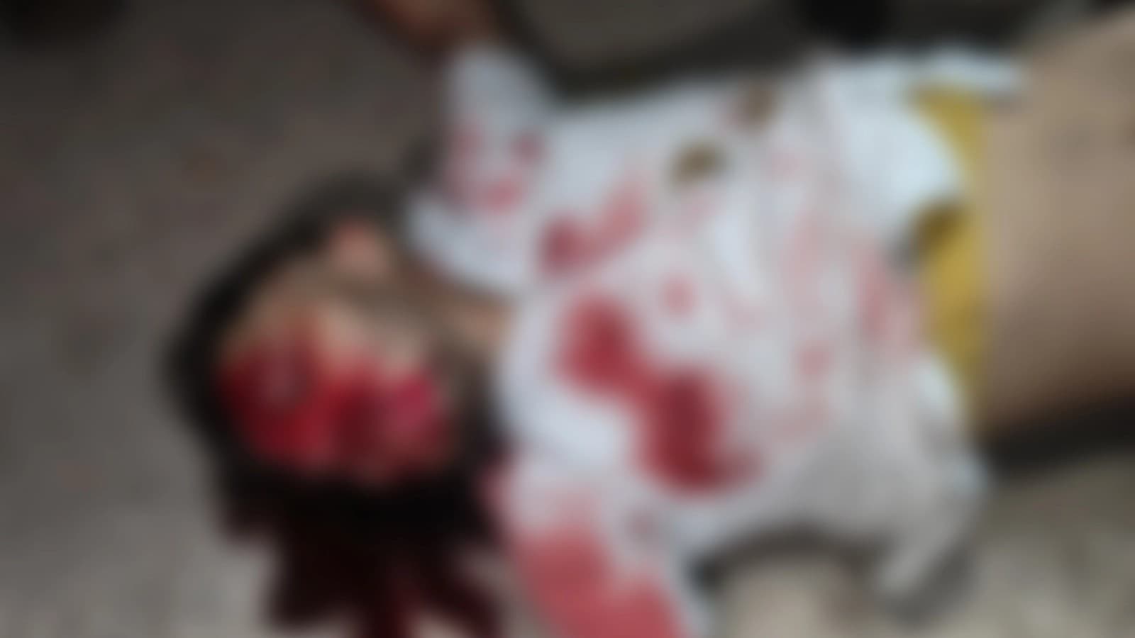 Agra News: पेड़ से टकराकर बाइक सवार की मौत, दो बाइकों के रेस के दौरान हुआ दर्दनाक हादसा