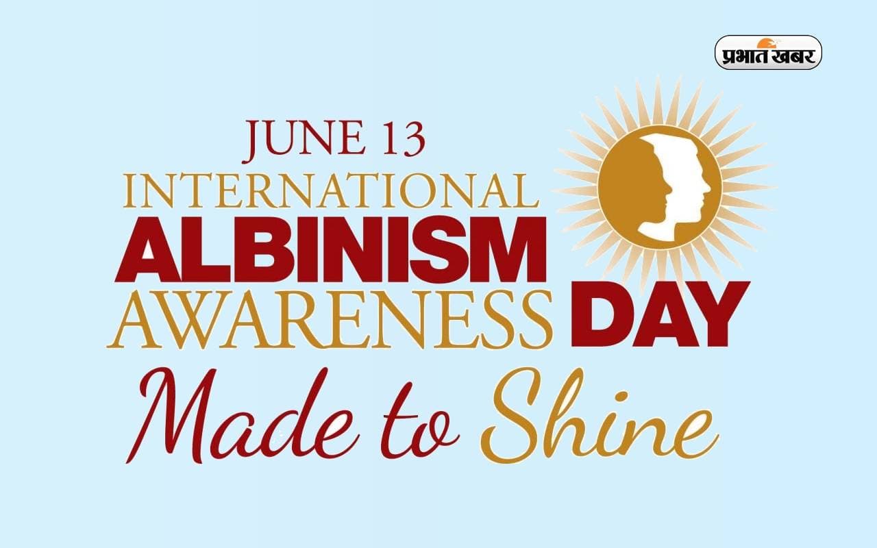 International Albinism Awareness Day 2023: अंतरराष्ट्रीय रंजकहीनता जागरूकता दिवस आज, जानें इसके बारे में