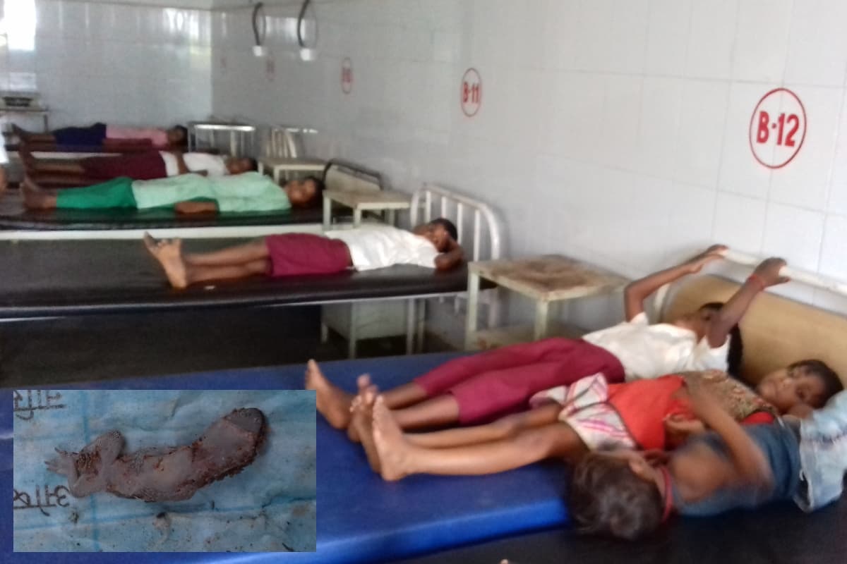 झारखंड : मिड-डे मील खाने से कई बच्चे बीमार, थाली में मिली छिपकली, एक ही दिन दो स्कूलों में घटी घटना