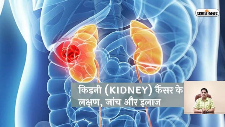 Kidney Cancer Signs, Symptoms and Treatment: क्या संभव है किडनी के कैंसर का इलाज, जानें डॉक्टर की राय