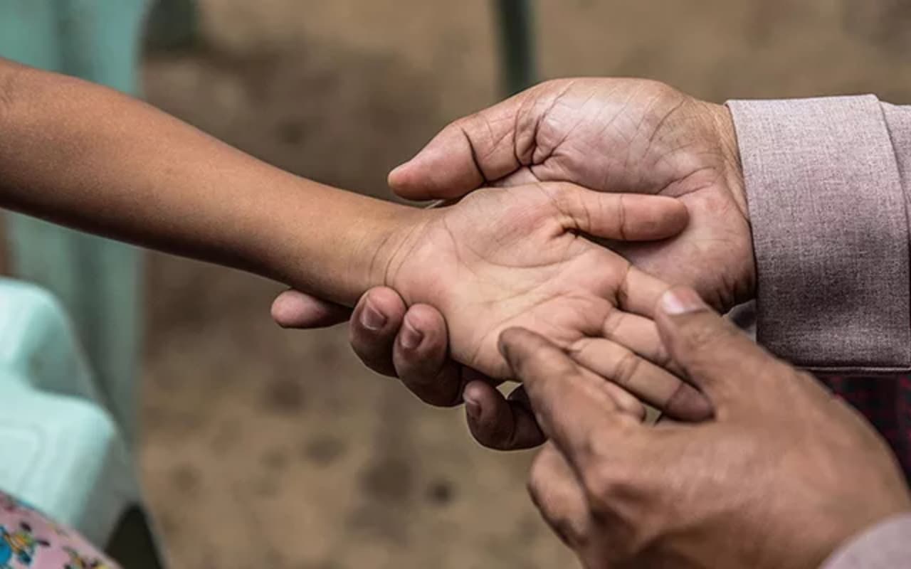 झारखंड में कुष्ठ रोगियों की पहचान कर रही सरकार, छुपाएं नहीं, पूरी तरह ठीक हो सकती है यह बीमारी