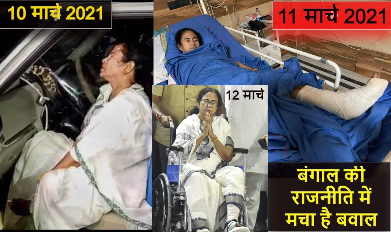 24 घंटे में ही प्लास्टर से क्रेप बैंडेज! हमें तो मालूम ही नहीं था कि हड्डी के इलाज में बंगाल इतना आगे निकल गया है