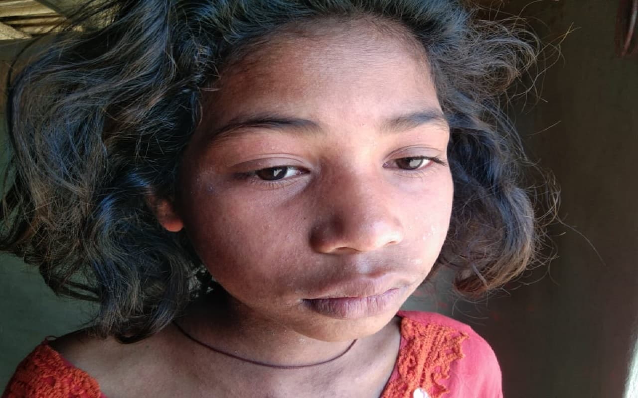 झारखंड: मीजल्स से तेजी से पीड़ित हो रहे बच्चे-बूढ़े, सहमे हैं ग्रामीण