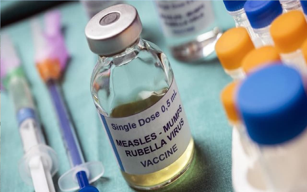 झारखंड सहित इन राज्यों में खसरे का खतरा! केंद्र ने 3 राज्यों में तैनात की हाई लेवल टीम