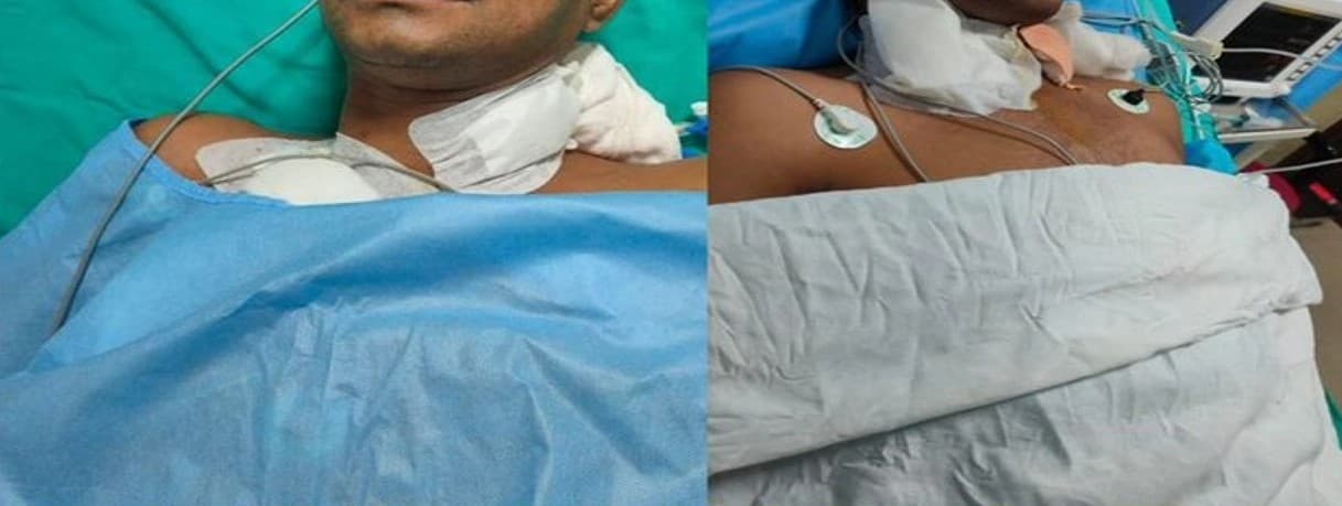 मिसाल : ब्रेन डेड महिला के अंगों ने सेना के दो जवान समेत पांच लोगों की बचाई जान