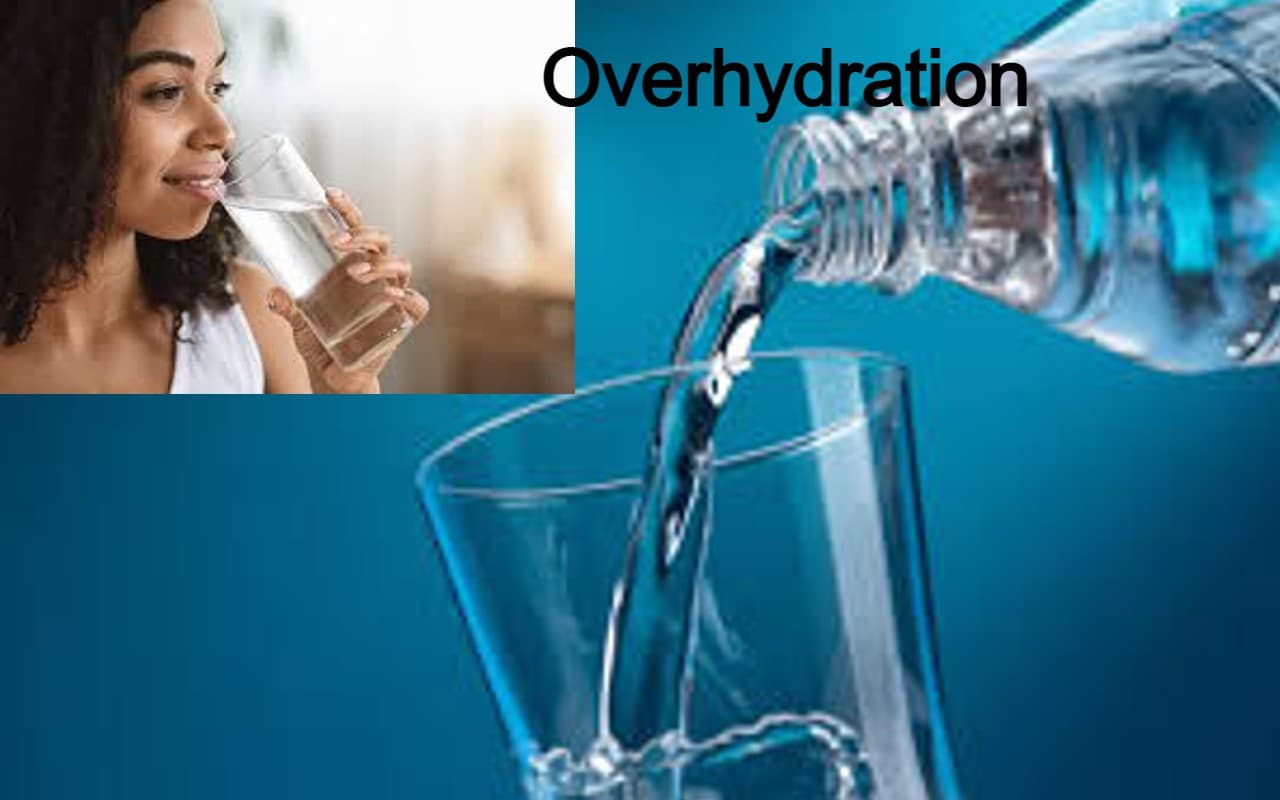 Overhydration क्या है? मौत की बन सकती है वजह! जानें वजन के अनुसार आपको कितना पानी पीना चाहिए