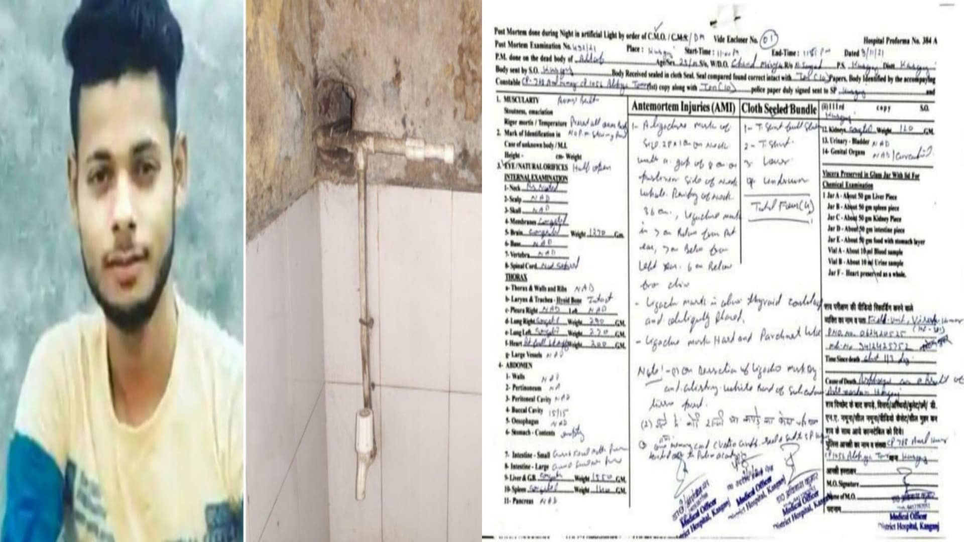 Kasganj News: अल्ताफ खुद फांसी पर लटका या पुलिस ने लटकाया, जानें क्या कहती है पोस्टमार्टम रिपोर्ट Kasganj News: अल्ताफ खुद फांसी पर लटका या पुलिस ने लटकाया, जानें क्या कहती है पोस्टमार्टम रिपोर्ट