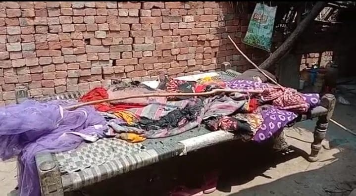 Pilibhit News: बेटी से छेड़छाड़ की शिकायत करने पर पति-पत्नी पर एसिड अटैक, चौकी इंचार्ज संस्पेंड