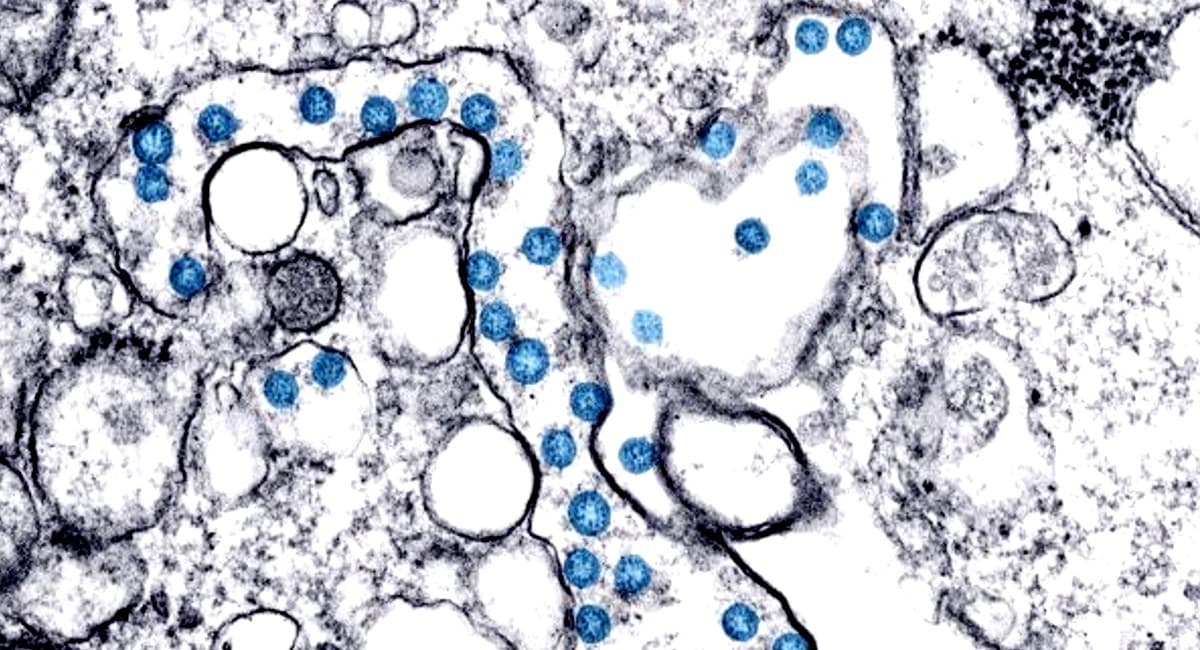 Coronavirus Omicron variant: ओमिक्रोन के बीए.2.75 उपस्वरूप का भारत में प्रसार सीमित- रिपोर्ट
