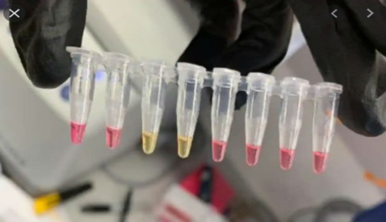 अब महज 45 से 60 मिनट में ही मिल जाएगी कोविड-19 की जांच रिपोर्ट, पढ़ें पूरी खबर...