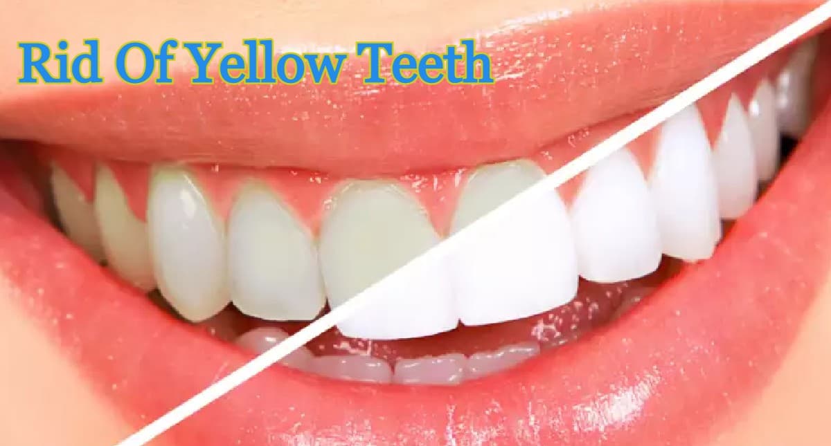 Rid Of Yellow Teeth: दांतों के नैचुरल कलर को खराब करते हैं ये फूड्स, पीलेपन के लिए हैं जिम्मेदार, जानें