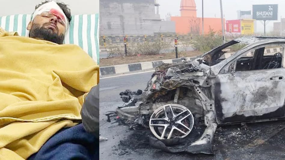 Rishabh Pant Car Accident: मर्सिडीज कार के इन सेफ्टी फीचर्स ने बचायी ऋषभ पंत की जान! Rishabh Pant Car Accident: मर्सिडीज कार के इन सेफ्टी फीचर्स ने बचायी ऋषभ पंत की जान!