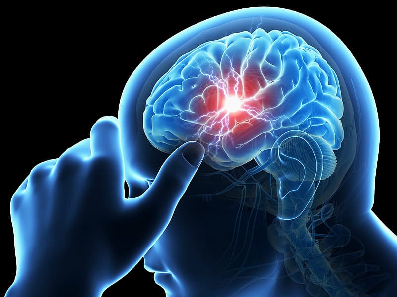 बीपी बढ़ने से आठ साल के बच्चे काे ब्रेन स्ट्रोक, मेडिका में हुआ इलाज