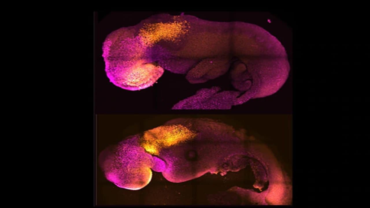 वैज्ञानिकों ने दुनिया का पहला दिमाग और धड़कते दिल वाला सिंथेटिक भ्रूण बनाया: रिपोर्ट