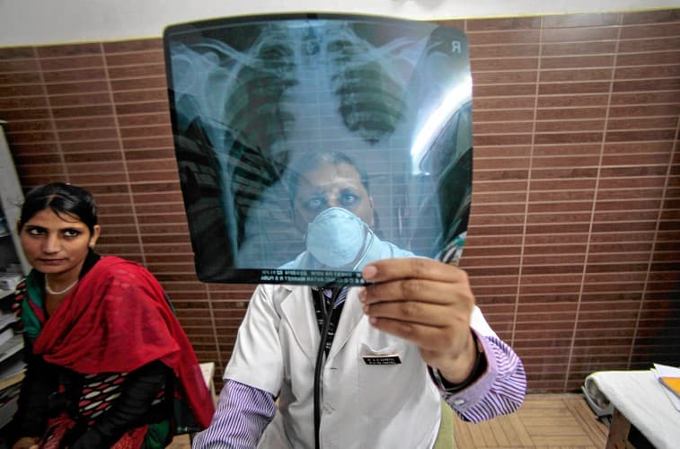 Jharkhand News : झारखंड में टीबी के मरीजों की तलाश शुरू, रांची में 20 अक्टूबर तक चलेगा अभियान