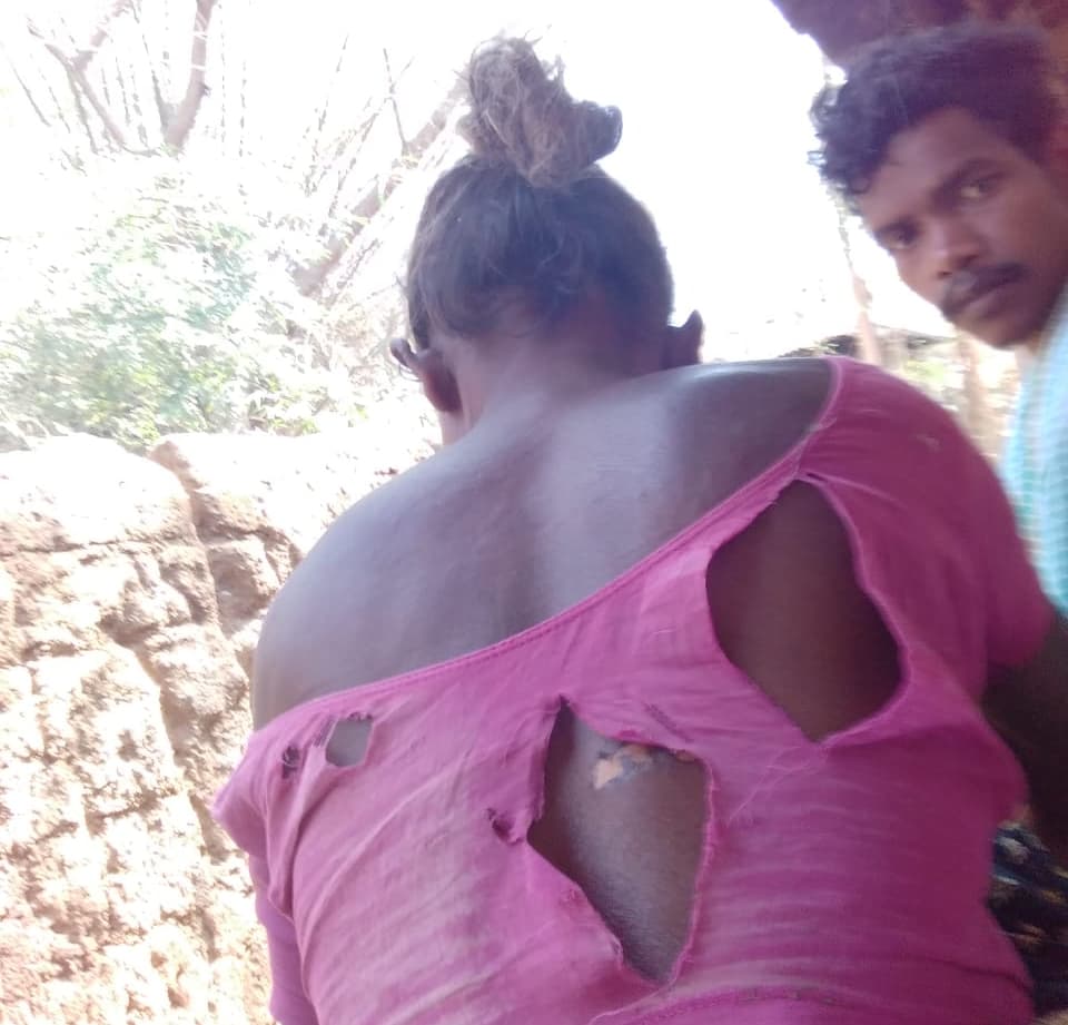 खड़गपुर में भाजपा नेता ने आदिवासी महिला को डायन बताकर पीटा, गर्म छड़ से दागा