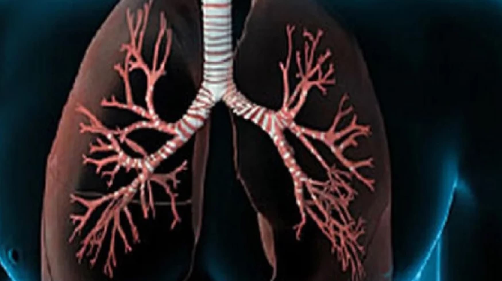 कोरोना वायरस फेफड़ों की कोशिकाओं को कैसे कुछ ही घंटे क्षति पहुंचाता है, वैज्ञानिकों ने पता लगाया