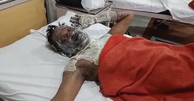 Lucknow News: लखनऊ के हजरतगंज चौराहे पर उन्नाव के युवक ने की खुदकुशी की कोशिश, पेट्रोल डालकर लगाई आग