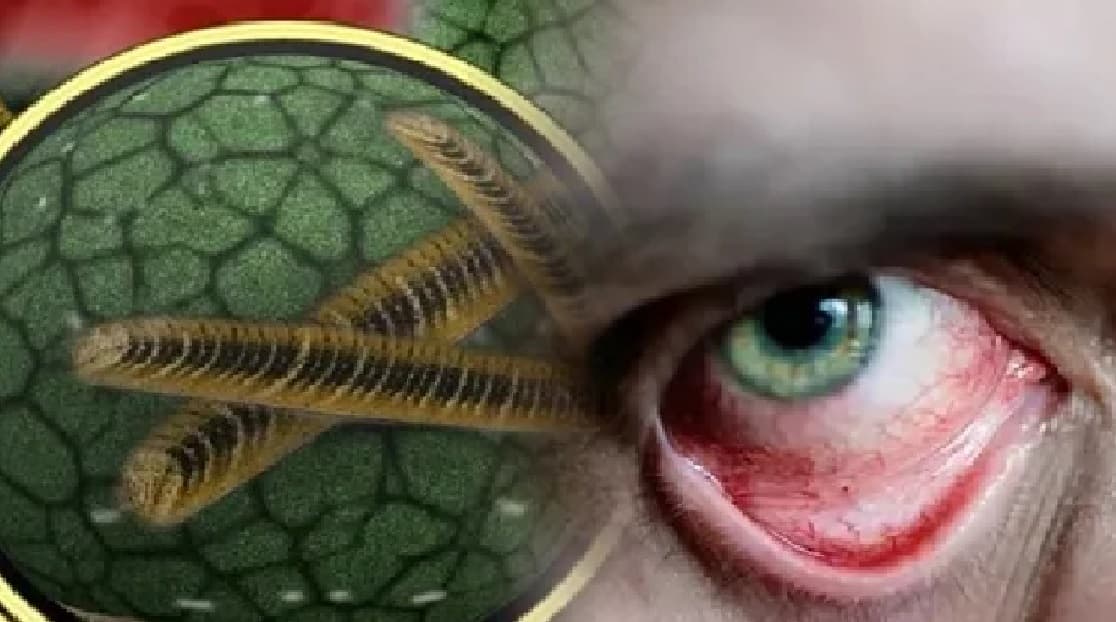 देश में बढ़ रहे हैं ब्लैक फंगस के मामले, देश के 60 फीसदी मामले इन राज्यों से