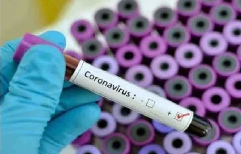 Delhi Corona News: दिल्ली में कोरोना के सामने आए 729 नए केस, मंकीपॉक्स से संक्रमित व्यक्ति की हालत स्थिर