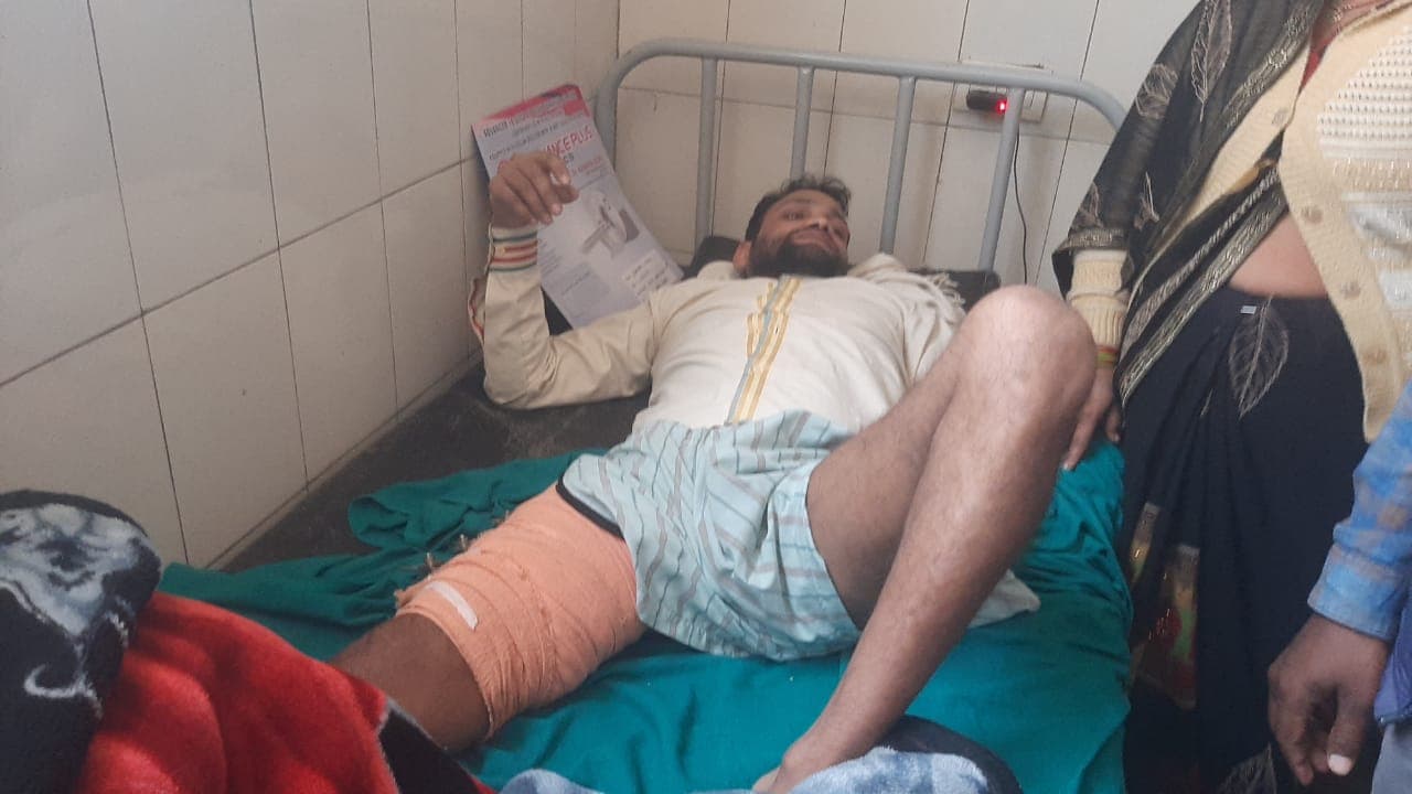 Agra News: चोट लगी बाएं पैर में, डॉक्टर ने दाएं का कर दिया ऑपरेशन, अब स्वास्थ्य विभाग दे रहा गोलमोल जवाब