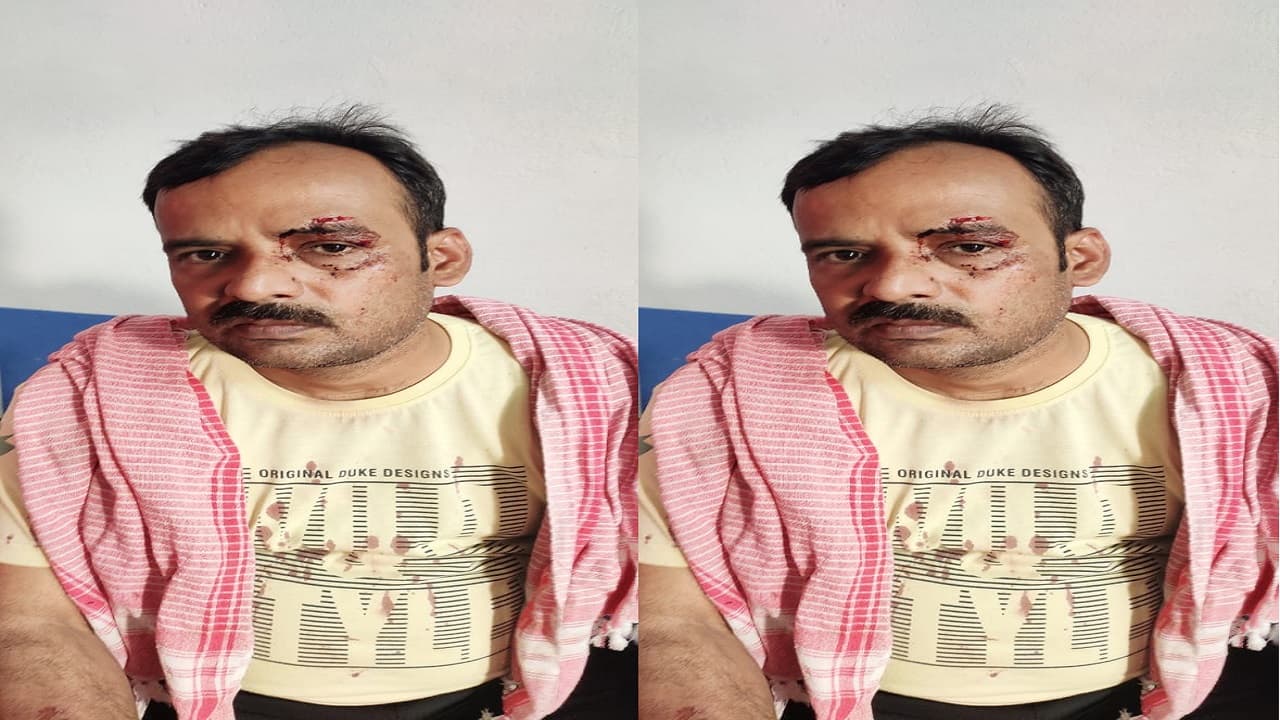 दीवाली पर सामान का पैसा मांगना दुकानदार को पड़ा भारी, ग्राहक ने पहुंचाया अस्पताल, जानें पूरा मामला