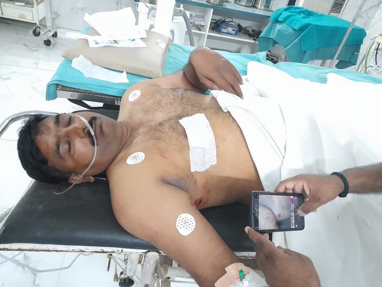 Varanasi News: वाराणसी में खाकी पर हमला, उपनिरीक्षक को गोली मारकर बदमाशों ने लूटी पिस्टल, बदमाश फरार