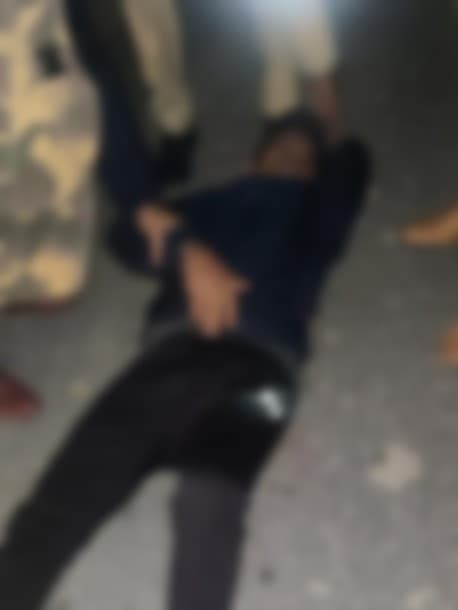 Agra News: आगरा पुलिस ने इनामी बदमाश को किया गिरफ्तार, मुठभेड़ में गोली लगने से घायल,अस्पताल में भर्ती