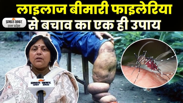 Uttar Pradesh सरकार अभियान चलाकर Filaria का करेगी खात्मा