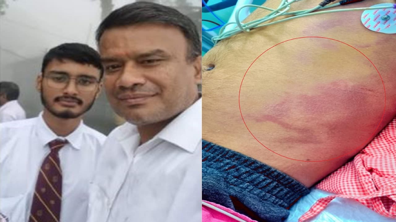 Rehabilitation center में मौतः 24 घंटे बाद भी पुलिस के हाथ खाली, बाप ने कहा इंसाफ के लिए कुछ भी करूंगा..