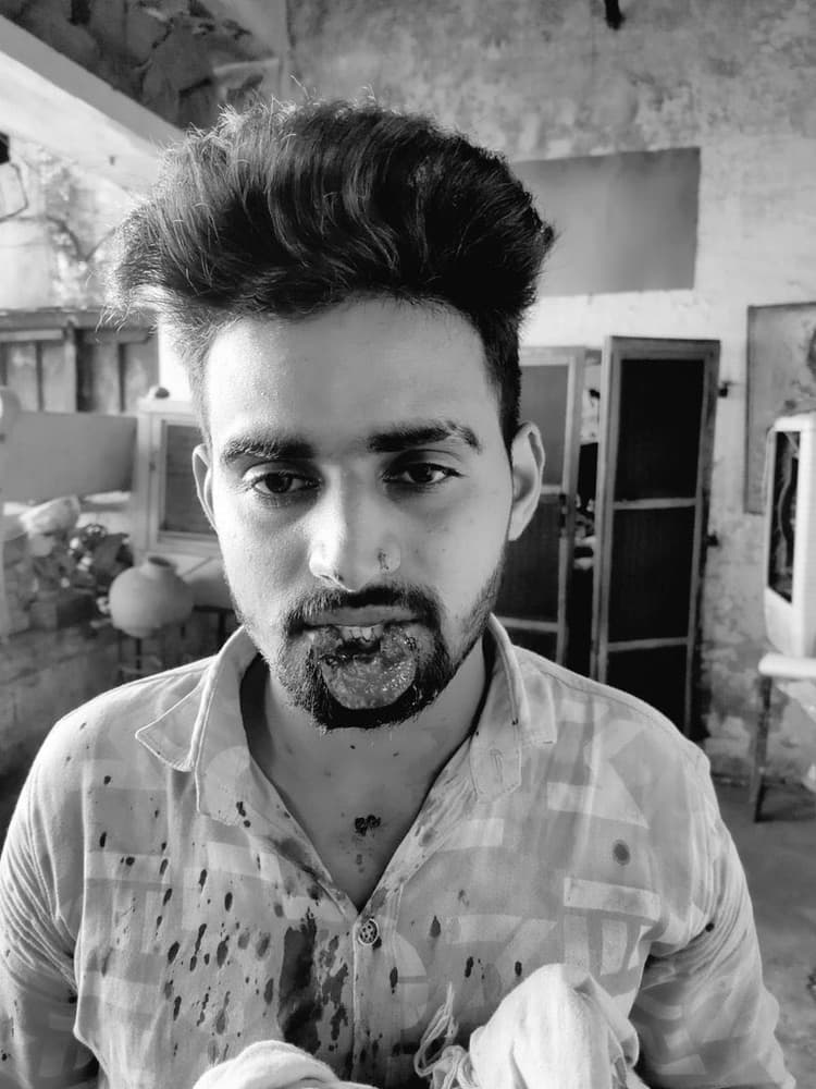 Meerut: युवक ने पकड़कर क‍िया Kiss तो मह‍िला ने काट द‍िया होंठ, पुलिस ने पैकेट में किया सील, अस्‍पताल में भर्ती