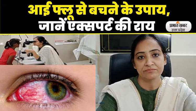 Eye Flu : Agra में Eye Flu का बढ़ रहा प्रकोप, एक्सपर्ट से जानें, बीमारी के लक्षण और Treatment