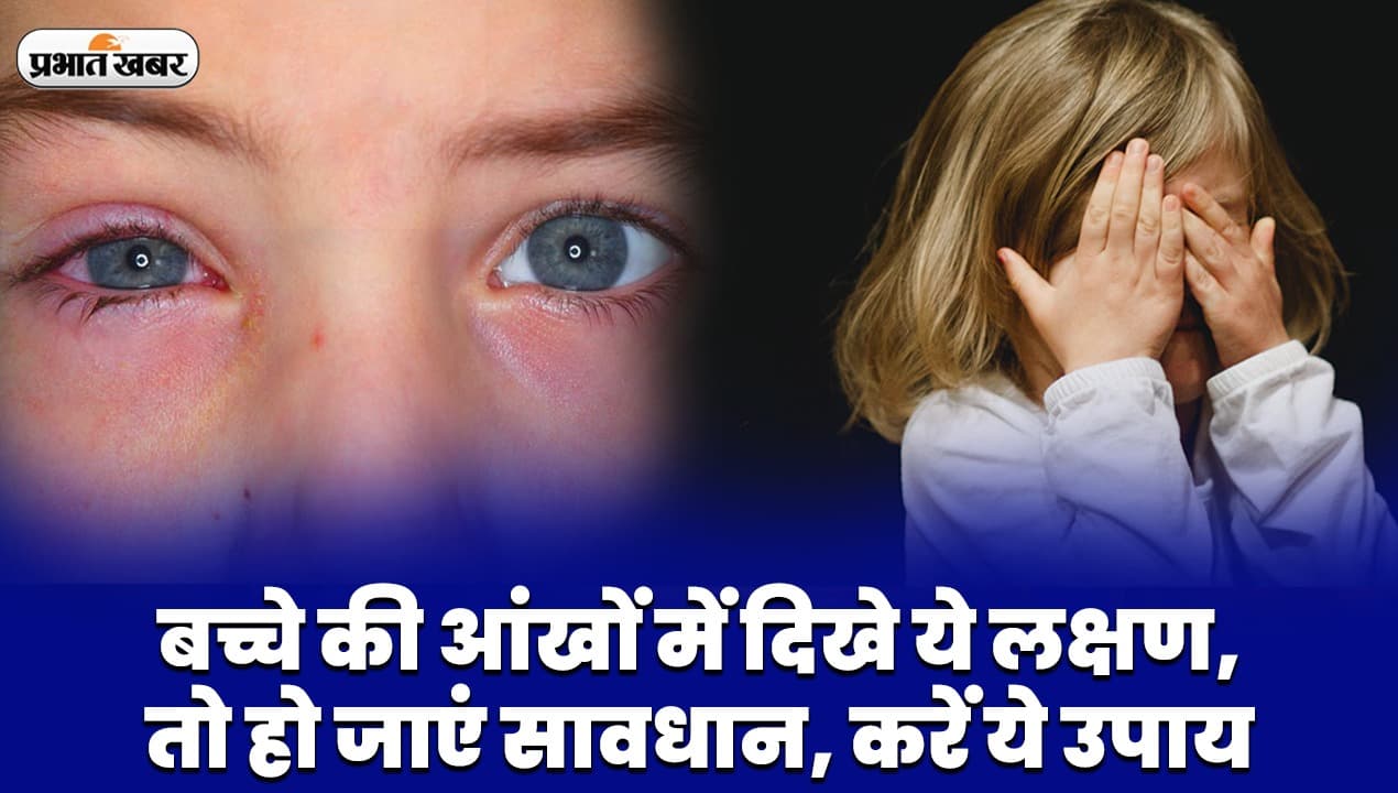 VIDEO: बच्चे की आंखों में दिख रहे इन लक्षणों को न करें नजरअंदाज, करें ये उपाय