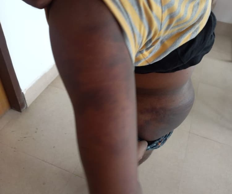 बिहारः थर्ड डिग्री कांड में कोर्ट गंभीर, नगर थानाध्यक्ष समेत तीन पुलिस अफसर पर सम्मन जारी