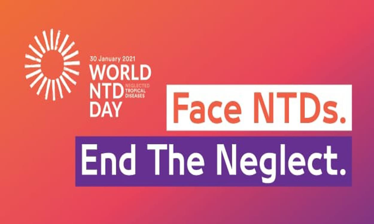 World NTD Day 2021 : 30 जनवरी को नेग्लेक्टेड ट्रॉपिकल डिजीज दिवस, लोगों को जागरूक करने का प्रयास