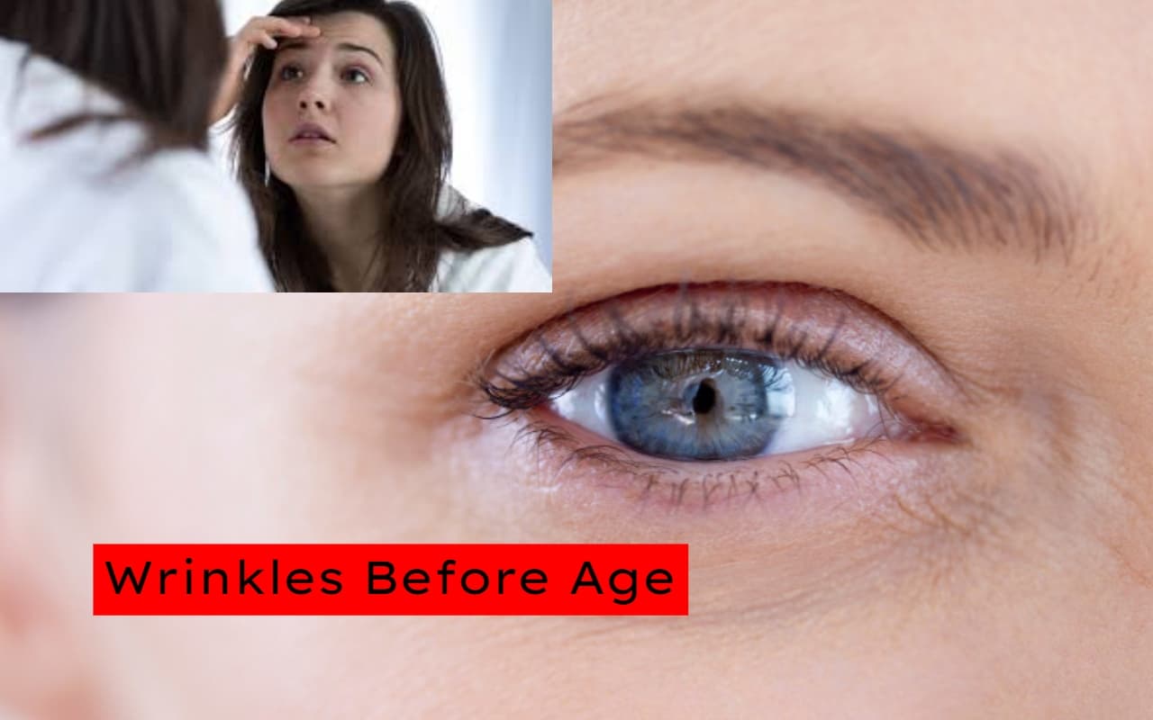 Wrinkles Before Age: उम्र से पहले झुर्रियों के क्या हैं कारण, उपाय जान लें