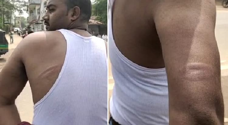 ये अफसरों की गुंडागर्दी नहीं तो और क्या है! एसडीओ व डीटीओ ने फाइन काटा, पिटाई की और झूठे केस में फंसाने की धमकी भी दी