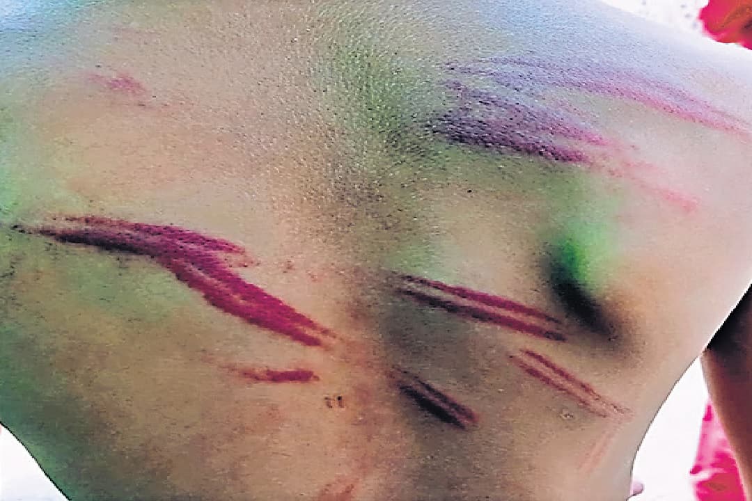 Bihar News: कलम नहीं लाने पर शिक्षक ने दी ऐसी सजा, जानकार रह जाएंगे हैरान, जानें पूरा मामला